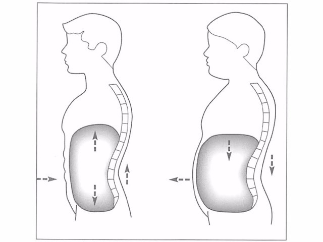 図2 -8. 体幹部周辺の筋力強化によって腰背部の正しい姿勢が維持しやすくなり、腰痛予防にも効果的（山本、1995より改変）