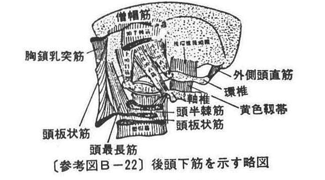 (参考図B-22)後頭下筋を示す略図