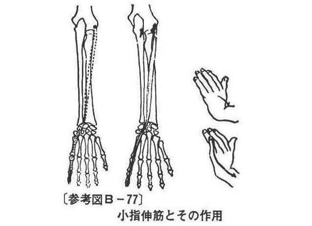 (参考図B-77）小指伸筋とその作用