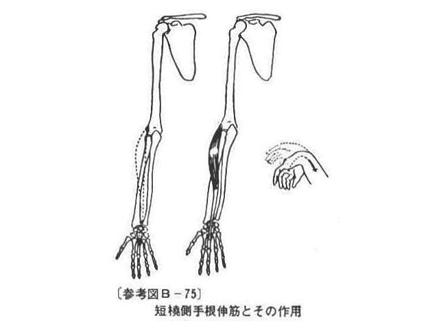 (参考図B-75)短穂側手根伸筋とその作用
