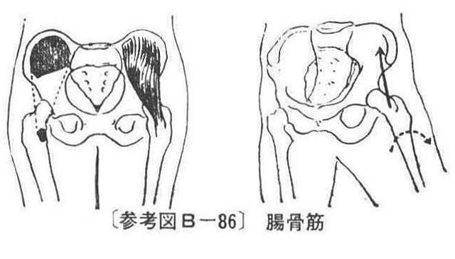 〔参考図B―86〕　腸骨筋