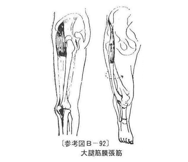 〔参考図B―92〕　大腿筋膜張筋
