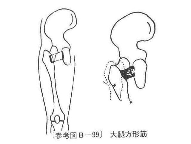 〔参考図B―99〕　大腿方形筋