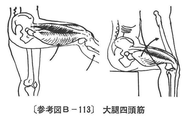 〔参考図B-113〕　大腿四頭筋