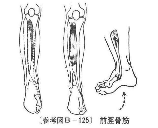 〔参考図B-125〕　前脛骨筋