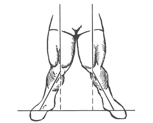 フォームが固まらないうちは、ウェイトが重くなるにつれ、立ち上がる動作の時に膝を内側に絞り込んで立とうとしてしまう場合がある。しかし、この膝を絞って立ち上がることは、膝関節に多大なストレスをかけることになる。膝頭は常に爪先と同じ方向に開いて上下運動させねばならない。